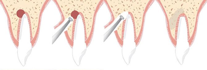 oralchirurgie oralchirurgie